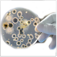 Agar Plates